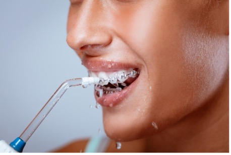 Close-up of a person's mouth with a water flosser or irrigator